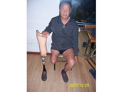 青島假肢與矯形器服務(wù)探析——以青島市遠(yuǎn)征假肢矯形器為例